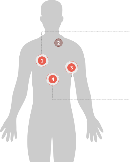 body